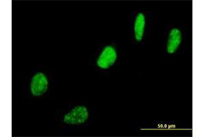 Immunofluorescence of purified MaxPab antibody to SNURF on HeLa cell.