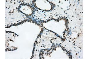 Immunohistochemical staining of paraffin-embedded prostate tissue using anti-ERCC1 mouse monoclonal antibody. (ERCC1 anticorps)