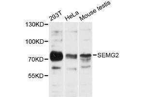 Western blot analysis of extracts of various cell lines, using SEMG2 antibody (ABIN6290952) at 1:3000 dilution.