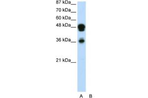 Western Blotting (WB) image for anti-Forkhead Box A1 (FOXA1) antibody (ABIN2460520) (FOXA1 anticorps)