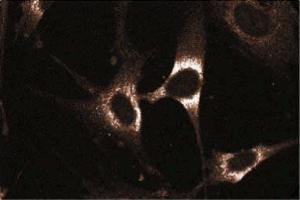 Immunoflourescent staining on WI-38 cells. (RAB5 anticorps  (AA 1-215))