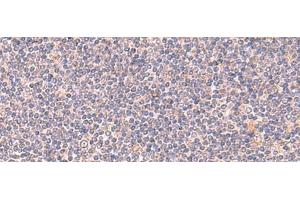 Immunohistochemistry of paraffin-embedded Human tonsil tissue using MANSC1 Polyclonal Antibody at dilution of 1:105(x200) (MANSC1 anticorps)