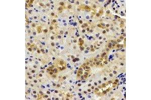Immunohistochemical analysis of DDX1 staining in mouse kidney formalin fixed paraffin embedded tissue section. (DDX1 anticorps)
