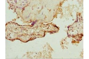 Immunohistochemistry of paraffin-embedded human placenta tissue using ABIN7176144 at dilution of 1:100 (ZNF195 anticorps  (AA 1-250))