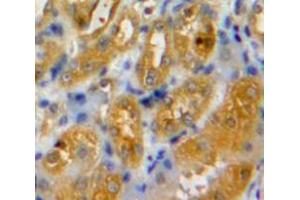 Used in DAB staining on fromalin fixed paraffin-embedded Kidney tissue (IRF6 anticorps  (AA 150-445))