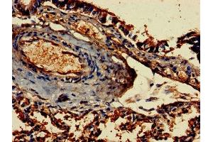 Immunohistochemistry of paraffin-embedded human lung tissue using ABIN7155188 at dilution of 1:100