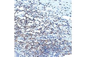 Immunohistochemistry of paraffin-embedded human appendix using CHD3 Rabbit mAb (ABIN7266363) at dilution of 1:100 (40x lens).