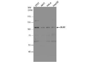 WB Image ULK2 antibody detects ULK2 protein by western blot analysis.