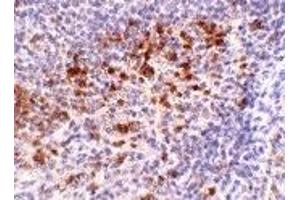 Immunohistochemistry (IHC) image for anti-Cathelicidin Antimicrobial Peptide (CAMP) (C-Term) antibody (ABIN1030321)