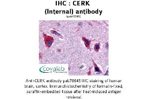 Image no. 1 for anti-Ceramide Kinase (CERK) (Internal Region) antibody (ABIN1733019) (CERK anticorps  (Internal Region))