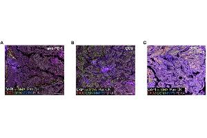 anti-Pyruvate Dehydrogenase Kinase, Isozyme 4 (PDK4) (AA 382-410) antibody