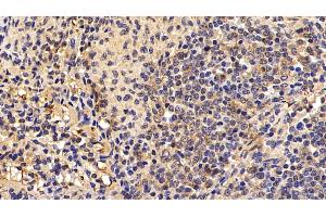 Detection of NFkB in Porcine Spleen Tissue using Polyclonal Antibody to Nuclear Factor Kappa B (NFkB)