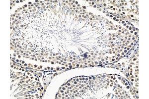 ABIN7096518 and ABIN7100582 at 1/100 staining rat testis tissue by IHC-P. (OSBPL11 anticorps)