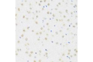 Immunohistochemistry of paraffin-embedded mouse brain using DDX50 antibody (ABIN6129371, ABIN6139509, ABIN6139510 and ABIN6224730) at dilution of 1:100 (40x lens). (DDX50 anticorps  (AA 1-135))