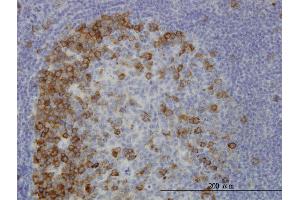 Immunoperoxidase of monoclonal antibody to TACC3 on formalin-fixed paraffin-embedded human tonsil.