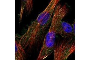 Immunofluorescent staining of human cell line U-251 MG with KIAA0408 polyclonal antibody ( Cat # PAB28278 ) at 1-4 ug/mL dilution shows positivity in cytoplasm & centrosome. (KIAA0408 anticorps)