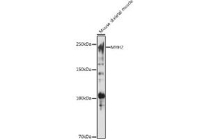 Western blot analysis of extracts of Mouse skeletal muscle, using MYH2 antibody (ABIN7268748) at 1:1000 dilution.