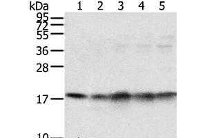 Western Blot analysis of Mouse brain and heart tissue, Jurkat, K562 and hela cell using TAF11 Polyclonal Antibody at dilution of 1:800 (TAF11 anticorps)