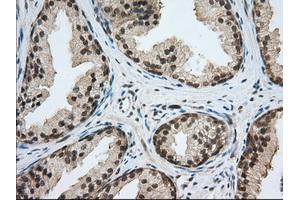 Immunohistochemical staining of paraffin-embedded Human liver tissue using anti-PDE4A mouse monoclonal antibody. (PDE4A anticorps)