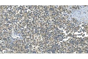 IHC analysis of IDH2 using anti-IDH2 antibody (ABIN7602786). (IDH2 anticorps  (C-Term))