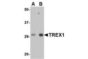 Image no. 1 for anti-three Prime Repair Exonuclease 1 (TREX1) (Internal Region) antibody (ABIN341718) (TREX1 anticorps  (Internal Region))