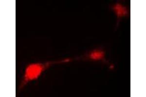 Immunofluorescent analysis of Parkin staining in HepG2 cells. (Parkin anticorps  (N-Term))