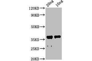 Western Blot Positive WB detected in Recombinant protein All lanes: ache antibody at 2. (Acetylcholinesterase anticorps  (AA 37-155))