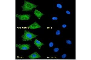 (ABIN184635) Immunofluorescence analysis of paraformaldehyde fixed A549 cells, permeabilized with 0. (MTMR9 anticorps  (C-Term))
