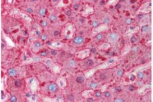 Human Liver (formalin-fixed, paraffin-embedded) stained with HP antibody ABIN214318 at 0. (Haptoglobin anticorps)