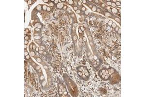 Immunohistochemical staining of human colon with TACC1 polyclonal antibody  shows moderate cytoplasmic positivity in glandular cells at 1:200-1:500 dilution.