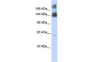 WB Suggested Anti-KTN1 Antibody Titration:  0.