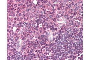 Anti-LAT2 antibody IHC of human tonsil.