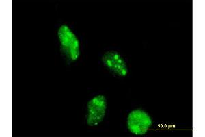 Immunofluorescence of monoclonal antibody to DOT1L on HeLa cell. (DOT1L anticorps  (AA 3-108))