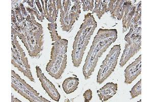 IHC analysis of CALR using anti-CALR antibody (ABIN7600329). (Calreticulin anticorps  (AA 18-323))
