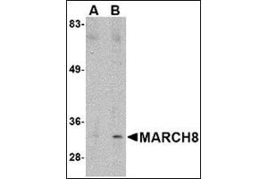 Western blot analysis of MARCH8 in HeLa cell lysate with this product at (A) 0. (MARCH8 anticorps  (C-Term))
