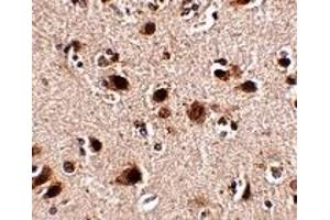 Immunohistochemistry (IHC) image for anti-SLIT and NTRK-Like Family, Member 5 (SLITRK5) (Middle Region 1) antibody (ABIN1031190) (SLITRK5 anticorps  (Middle Region 1))