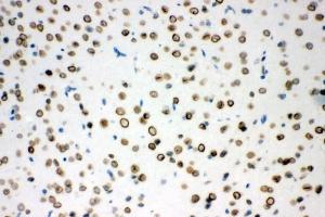 IHC analysis of Sumo 1/SUMO1 using anti-Sumo 1/SUMO1 antibody (ABIN7603002). (SUMO1 anticorps  (Middle Region))