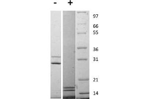 SDS-PAGE of Rat Interleukin-17AF Heterodimer Recombinant Protein SDS-PAGE of Rat Interleukin-17 Animal Free Recombinant Protein. (IL-17A/F Protéine)