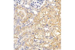 Immunohistochemistry of paraffin embedded mouse kidney using Clcn5 (ABIN7073471) at dilution of 1:200 (400x lens)