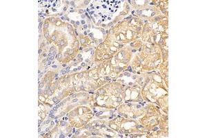 Immunohistochemistry of paraffin embedded mouse kidney using Clcn5 (ABIN7073471) at dilution of 1:200 (400x lens) (Chloride Channel 5 anticorps)