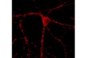 Immunolabeling of cultured hippocampus neurons (dilution 1 : 500).