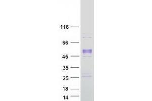 Validation with Western Blot