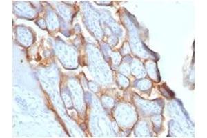 Formalin-fixed, paraffin-embedded human placenta stained with HCG-beta Rabbit Recombinant Monoclonal Antibody (HCGb/1996R). (Recombinant CGB anticorps)