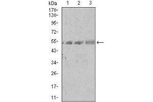 Western blot analysis using SPIB mouse mAb against A549 (1), PC-3 (2), and NIH3T3 (3) cell lysate. (SPIB anticorps  (AA 200-252))