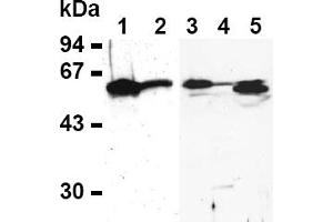 Western Blotting (WB) image for anti-E2F Transcription Factor 4, P107/p130-Binding (E2F4) antibody (ABIN487490) (E2F4 anticorps)