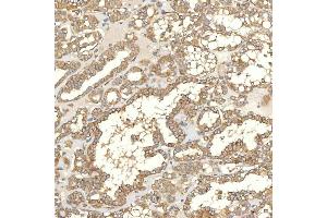 IHC analysis of TXNDC5 using anti-TXNDC5 antibody (ABIN7599699). (TXNDC5 anticorps  (AA 109-403))
