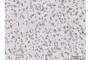 IHC analysis of RPL11 using anti-RPL11 antibody (ABIN7602315). (RPL11 anticorps  (AA 7-178))