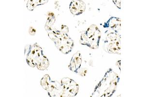 Immunohistochemistry of paraffin-embedded human placenta using QKI Rabbit mAb (ABIN7269699) at dilution of 1:1000 (40x lens).