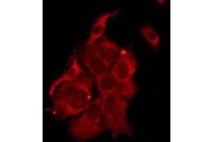 ABIN6276221 staining MCF7 by IF/ICC. (TAS2R14 anticorps  (Internal Region))