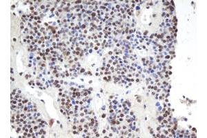 Image no. 4 for anti-Apurinic/Apyrimidinic Endonuclease 1 (APEX1) (AA 1-242) antibody (ABIN1490625)